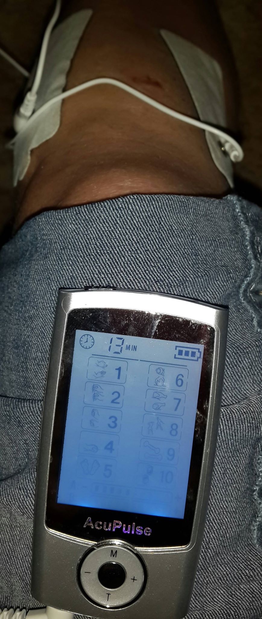 AP 1000