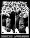Flaccid Genitals- Penile Avulsion Shirt