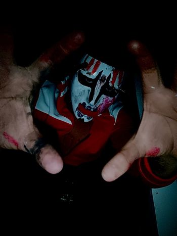 Burn victim upside down blood
