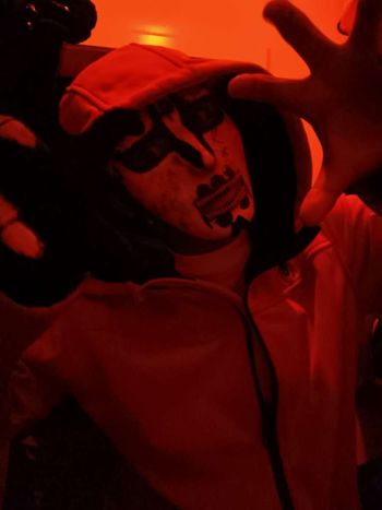 Burn victim upside down blood
