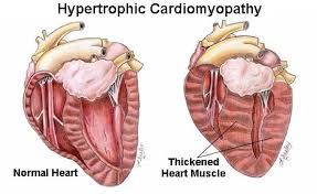 Bengal cat heart health awareness image