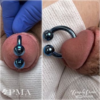 Reverse Prince Albert Piercing
