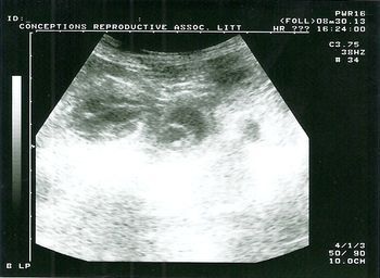 Ultrasound of Rio done on 8/30/13.  In the vet's words "she is full of puppies"!  So excited....
