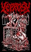 Leprosy "Cage"