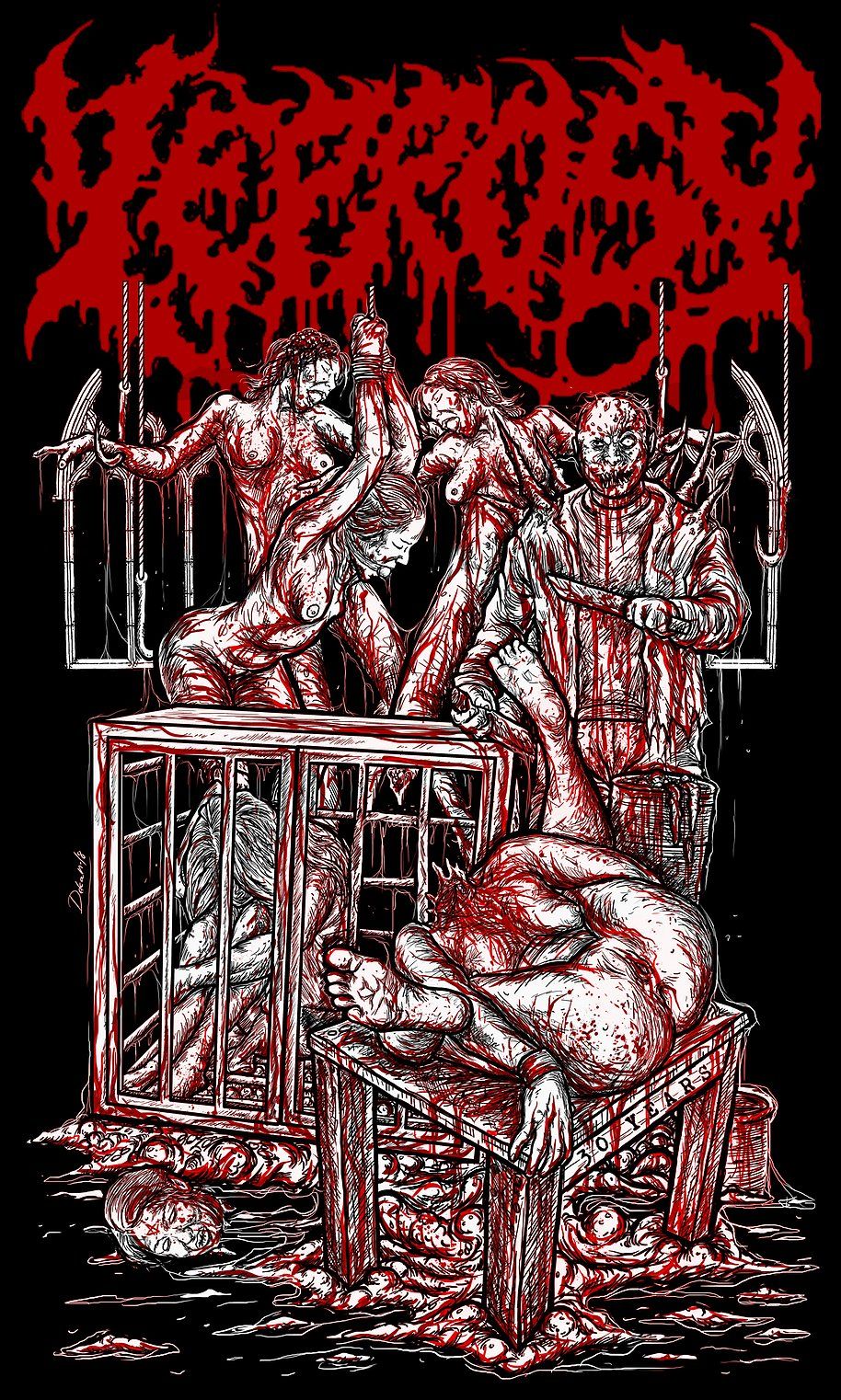 Leprosy "Cage"