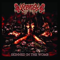 Skinned In The Womb by Leprosy
