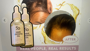 HAIR GOWTH OIL